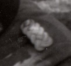 Unknown epaulette.jpg